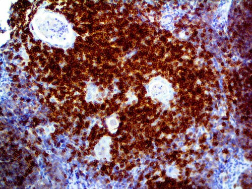 IHC of CD5 on an FFPE Thymus Tissue